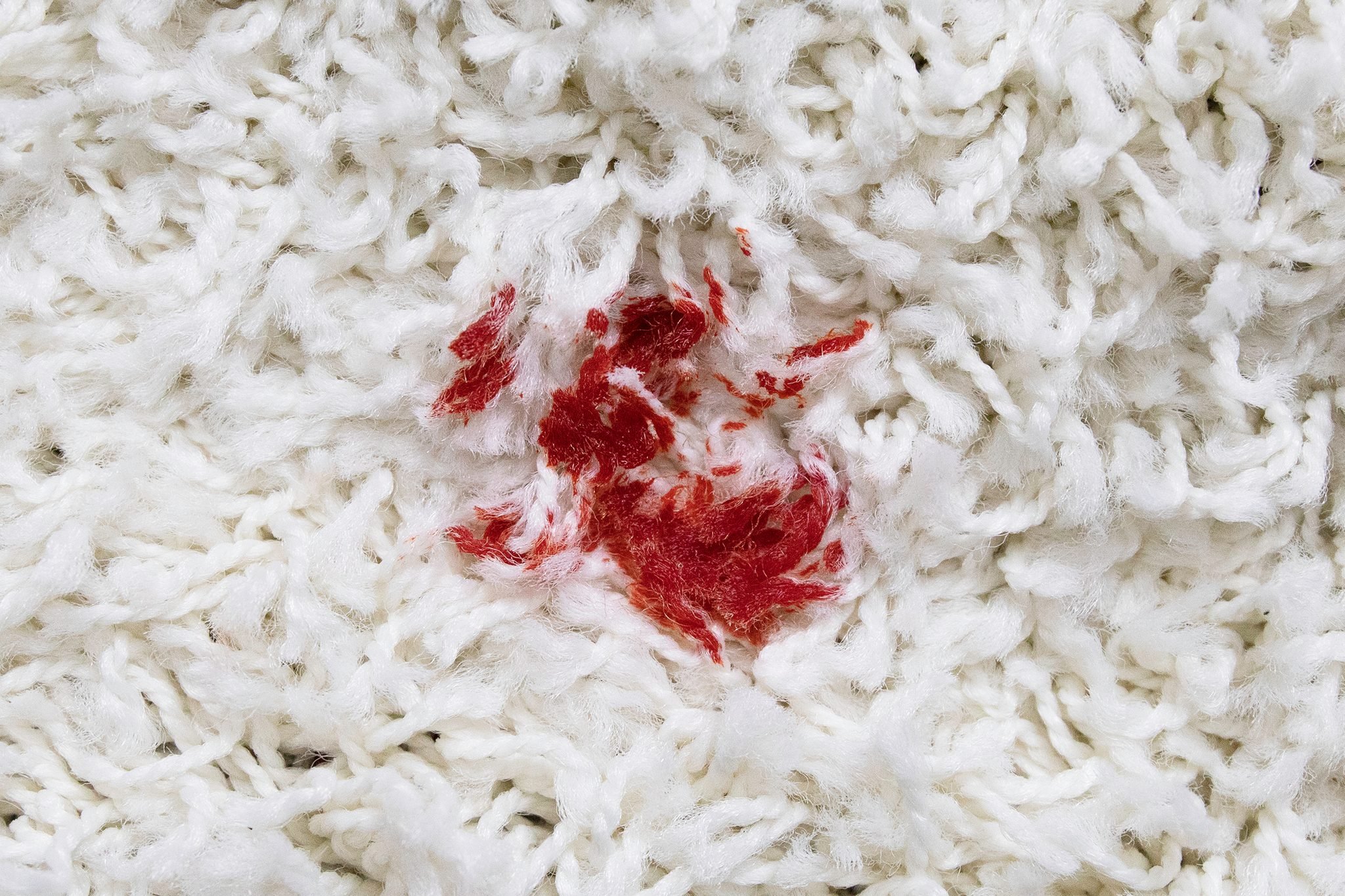 چگونه لکه های خون را از روی فرش پاک کنیم