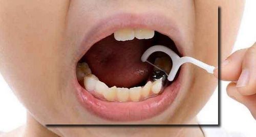 نخ دندان منظم باید باشد تا دندانتان خراب نشود