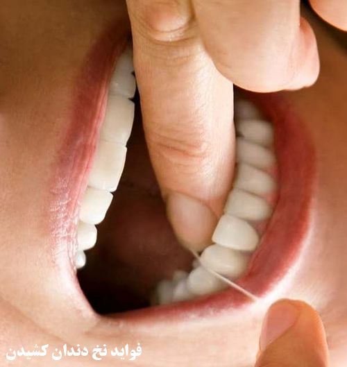 فواید و مزیت استفاده از نخ دندان چیست