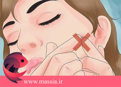 چگونه صورت بدون آکنه داشته باشیم؟
